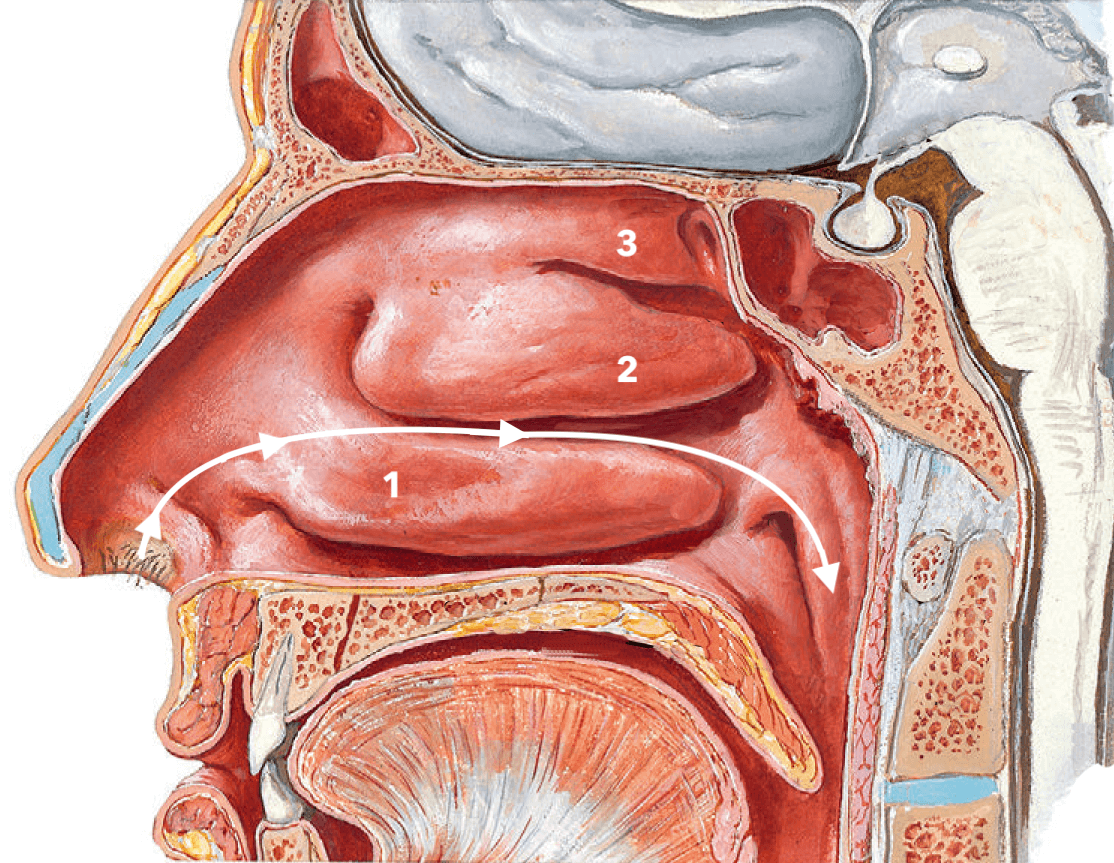 Στο πλάγιο τοίχωμα της μύτης υπάρχουν τρεις προεξοχές, που λέγονται κόγχες (1,2,3). Η κάτω ρινική κόγχη (1) είναι πολύ σημαντική για τη ρύθμιση της ροής του αέρα μέσα στη μύτη (βέλη). Όμως σε χρόνιες φλεγμονές, όπως η χρόνια ρινίτιδα, συχνές διογκώσεις οδηγούν σε μόνιμη υπερτροφία, η οποία προκαλεί παρεμπόδιση της ροής του αέρα. Σε αυτές τις περιπτώσεις απαιτείται χειρουργική μείωση του όγκου της κόγχης.