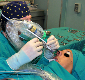 Διεύρυνση στομίων με μπαλόνι: Το αριστερό χέρι του χειρουργού κρατάει το ενδοσκόπιο, ενώ το δεξί προωθεί το μπαλόνι μέσα στη μύτη. Το εξωτερικό μέρος του σύρματος-οδηγού είναι ορατό να βγαίνει από το οπίσθιο τμήμα του εργαλείου τοποθέτησης.